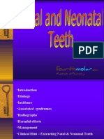 Natal Neonatal Teeth Pedo