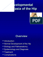 Developmental Dysplasia of The Hip