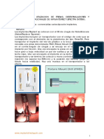 Protocolo Quirurgico Spectra Sistem Implant Direct