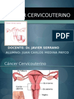 Cancer de Cervix 