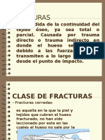 FRACTURAS