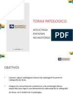 Teoria 05 Patologia de Torax Atelectasia Neumotorax