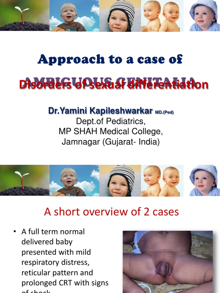 Understanding Ambiguous Genitalia Cases | PDF | Androgen | Intersex