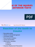 Sequelae of The Injuries To The Anterior Teeth (Pedo)