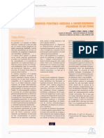 Polineuropatia Periferica Asociada a Adenocarcinoma Pulmonar en Un Perro