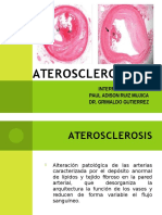 aterosclerosis