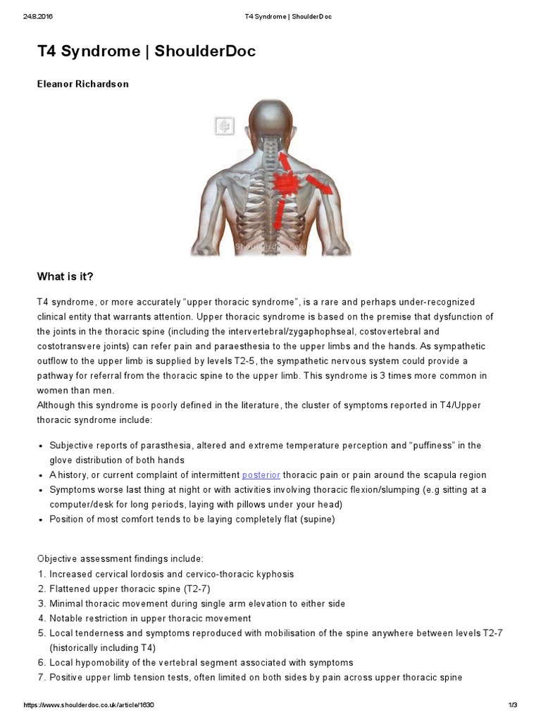 Understanding T4 Syndrome Symptoms and Treatment | PDF | Physical ...