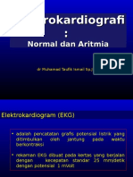 ECG & Arrhythmia_Taufik