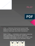 Ppt Inlay Onlay Uplay