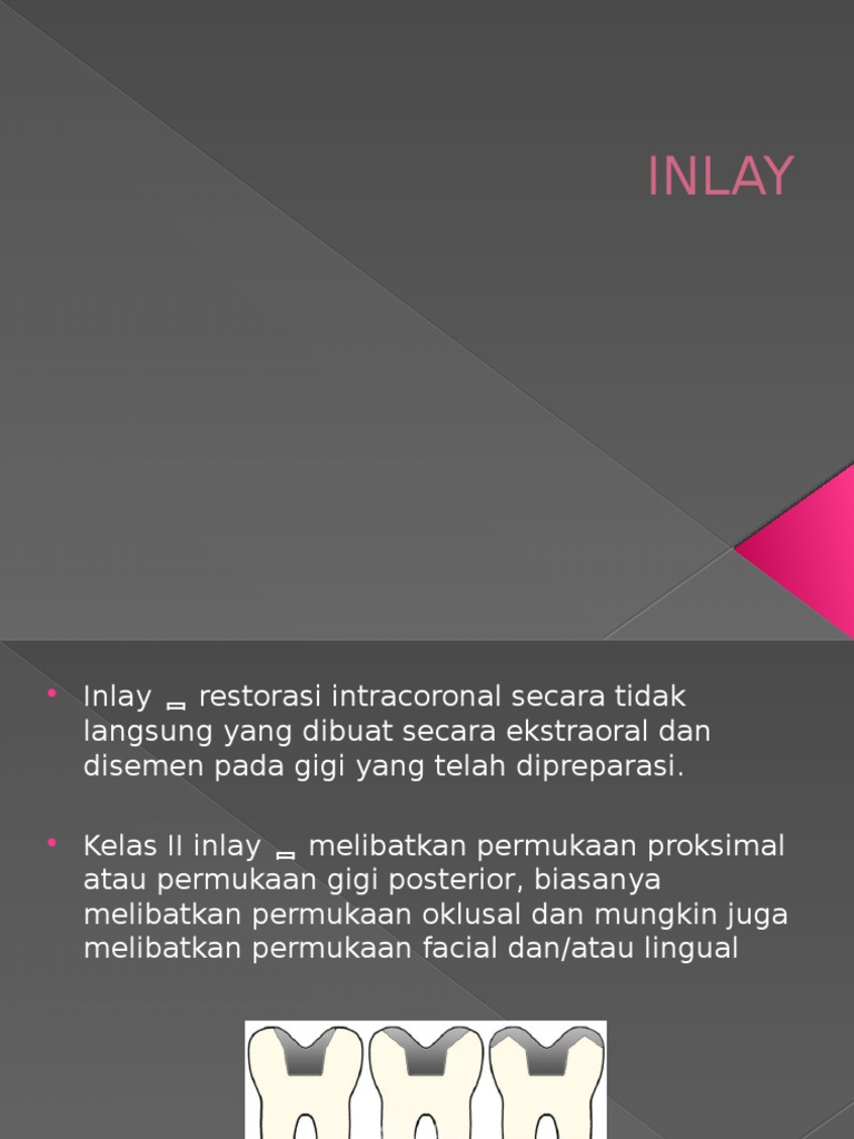 Indikasi dan Preparasi Inlay Gigi | PDF | Sains & Matematika ...