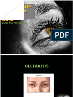 Abnormalitas Palpebra