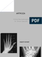 Artroza - reumatologie