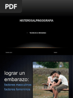 HISTEROSALPINGOGRAFIA