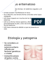 Lupus Eritematoso