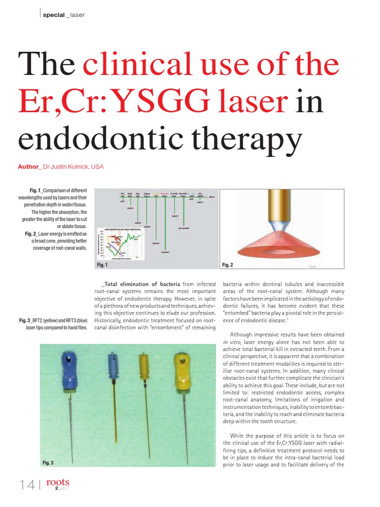 Lasers in EndoKolnick Mouth Health Treatment