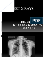 Chest X Rays: - DR - Sneha Istyr Radiology PG Sssmcri