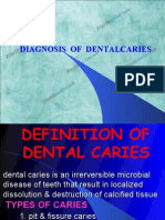 Diagnosis of Dental Caries Pedo