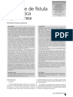 S+¡ndrome de F+¡stula Perilinf+ítica PDF