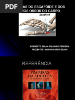 Fraturas Do Escafóide e Dos Outros Ossos Do Carpo