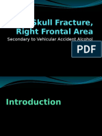 Open Skull Fracture, Right Frontal Area