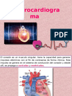 Electrocardiogra Ma