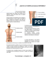 Fusion Vertebral