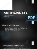 Artificial Eye: Baldon, Queeenie A. Bs Ece 4-3