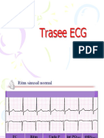 Trasee ECG