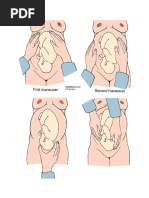 Download Cara Mengukur Dan Menghitung Tinggi Fundus Uteri by Luhtu Novi Sri Dewi SN323542424 doc pdf