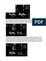 Doppler Artery Umbilikalis