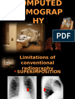 COMPUTED TOMOGRAPHY.pps