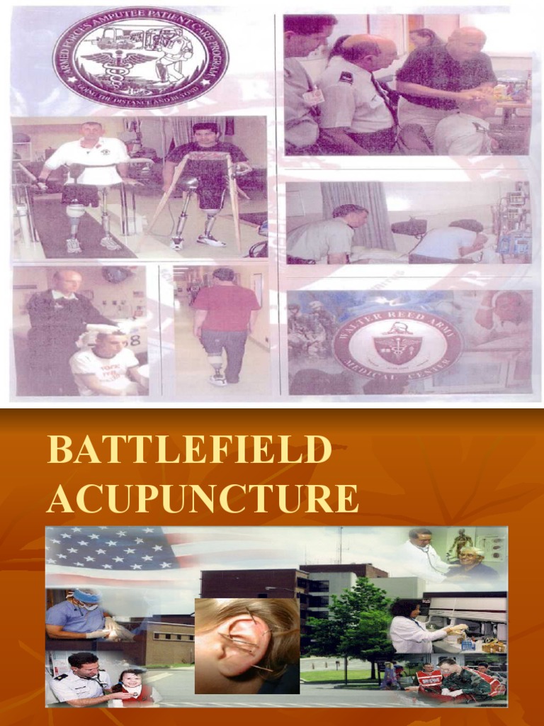 Pickett USAFP Battlefield Acupuncture (PPTminimizer) PDF