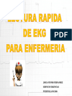 Lectura Rapida Ekg