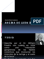 Angina de Ludwig