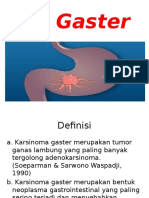 CA Gaster - Karsinoma Lambung