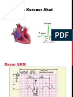 Sindrom Koroner Akut