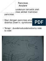 anulare pancreas.pptx