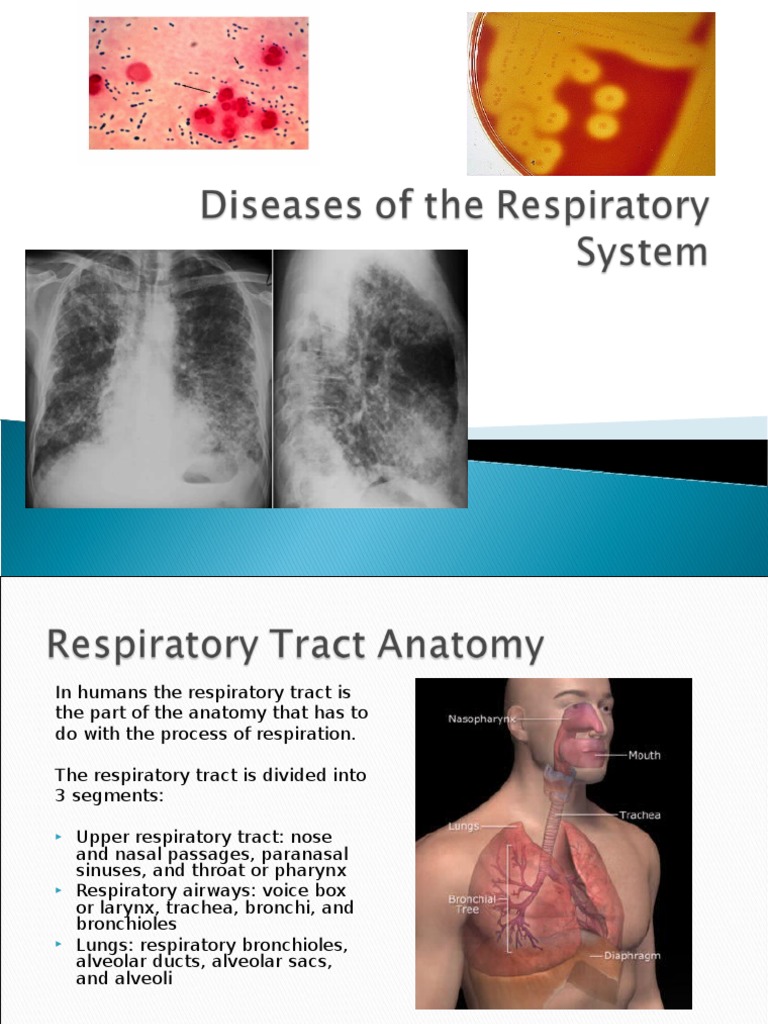 2420 Diseases of The Respiratory System 042810 FV | PDF