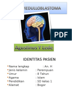 Medulloblastoma Anak