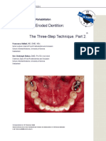 full-mouth-adhesive-rehabilitation.-the-three-stpe-techinique-part-2.doc