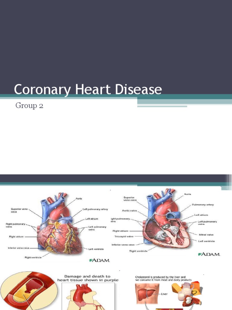 Understanding Coronary Heart Disease | PDF | Coronary Artery Disease ...