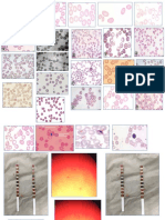 alteraciones-de-eritrocitos (1).pptx