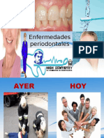 Enfermedades Periodontales