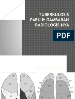 Radiologi TB