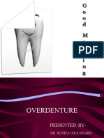 Overdenture