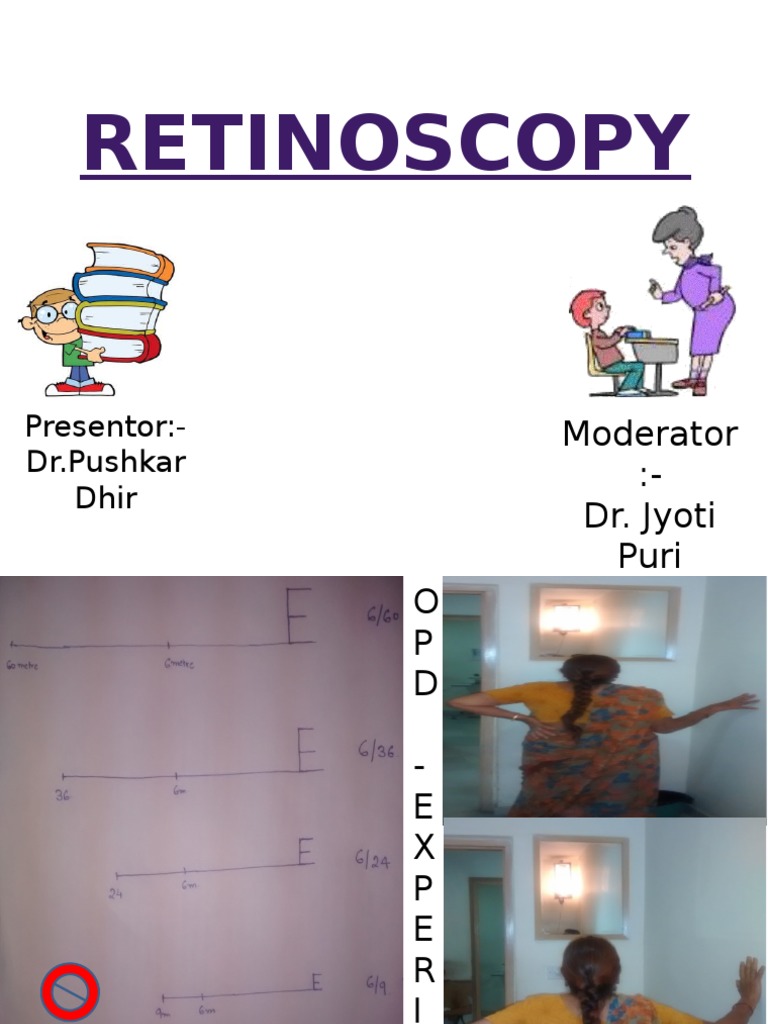 Retinoscopy ModeratorDr. Jyoti Puri PDF Lens (Optics) Optics