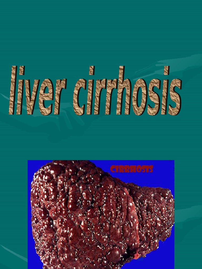 Liver Cirrhosis PDF Cirrhosis Liver