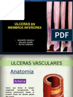 Ulceras en Miembros Inferiores