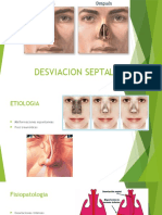 Desviacion Septal