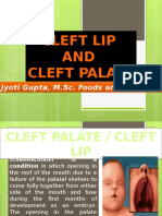 Cleft Lip and Cleft Palate